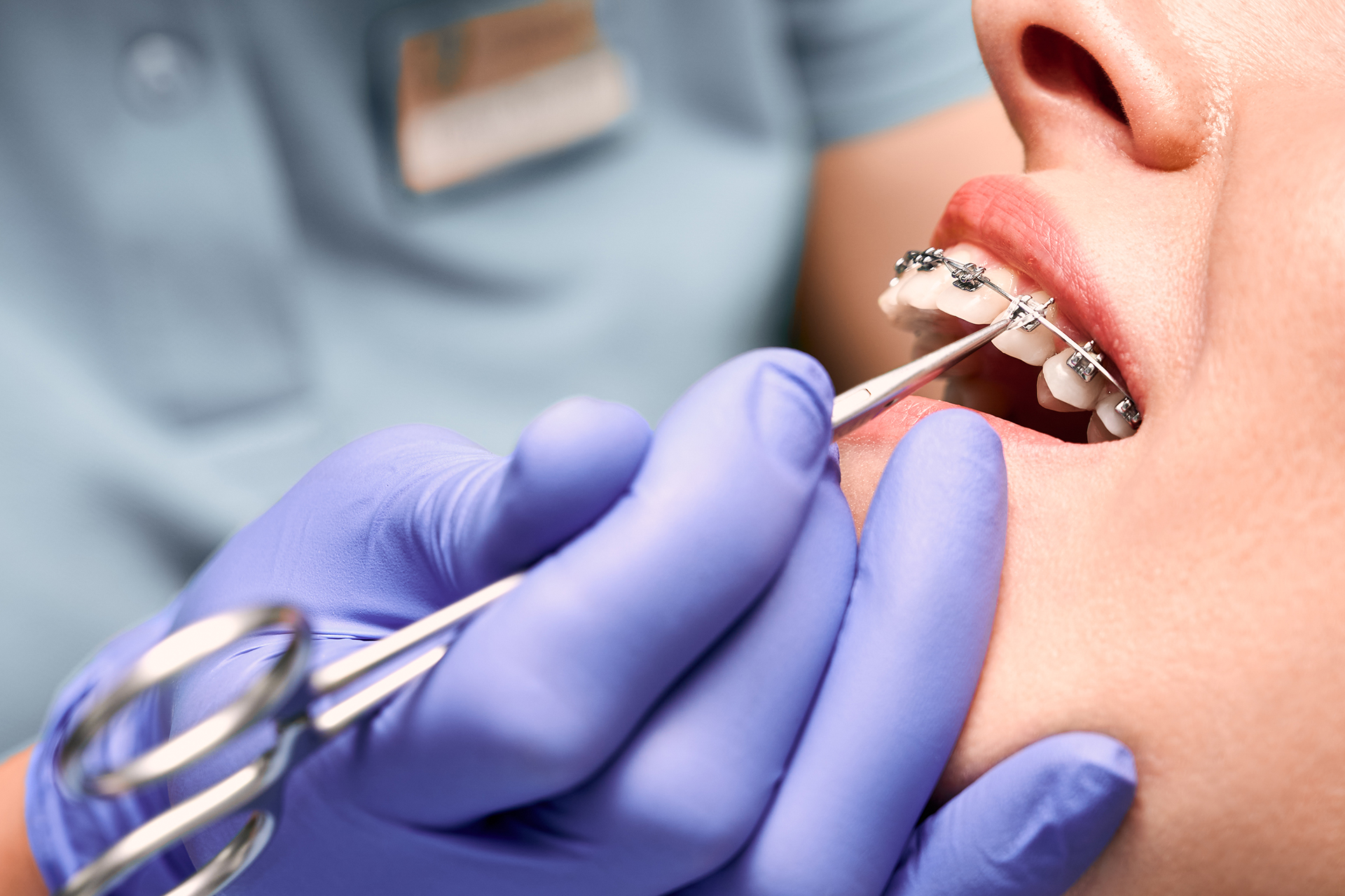 Orthodontic Treatment in Abu Dhabhi
