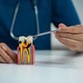 When Does a Tooth Infection Need a Root Canal?