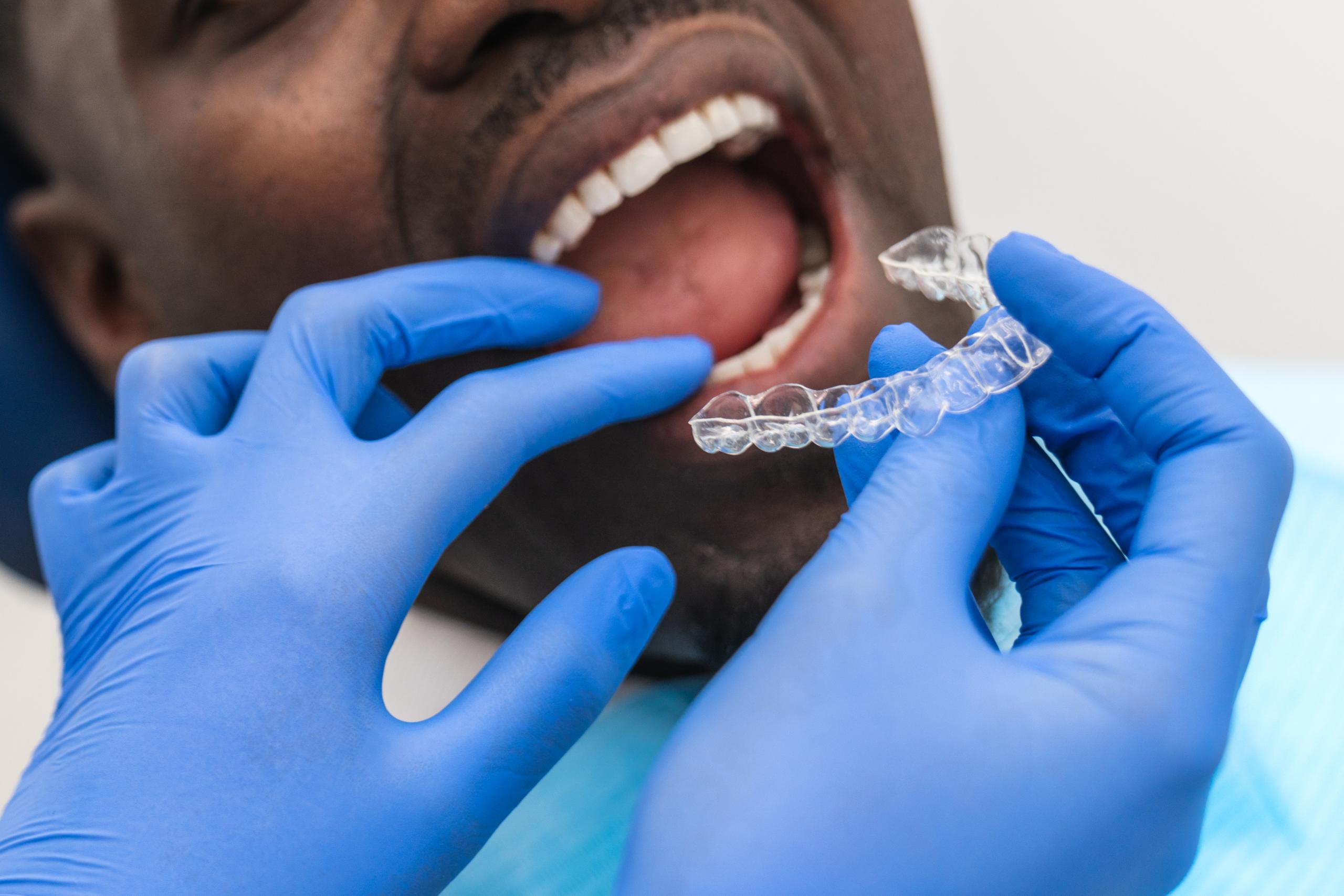 Invisalign Treatment Abu Dhabi