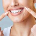Hollywood Smile: A Complete Guide to the Procedure