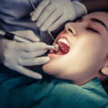 Signs You May Need Advanced Oral Surgery